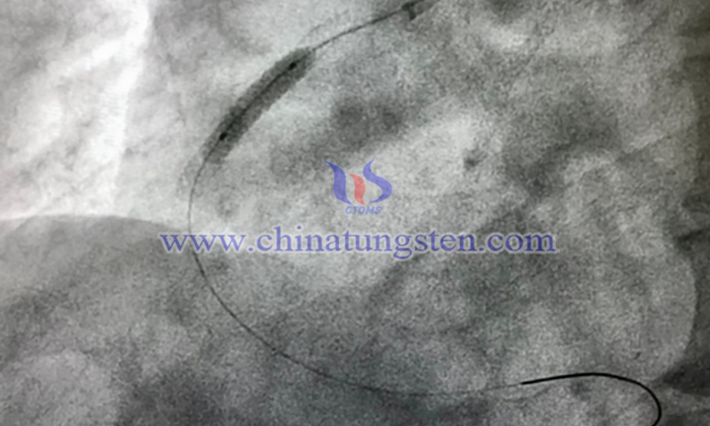 導(dǎo)絲用細(xì)金屬鎢絲